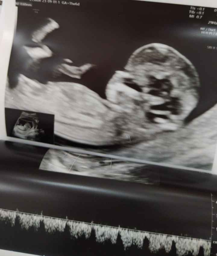 Future mamme di Marzo 2024 - 1