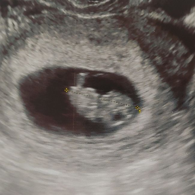 Future Mamme Ottobre 2021 - 1