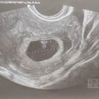 Metodo Ramzi è attendibile? - 2