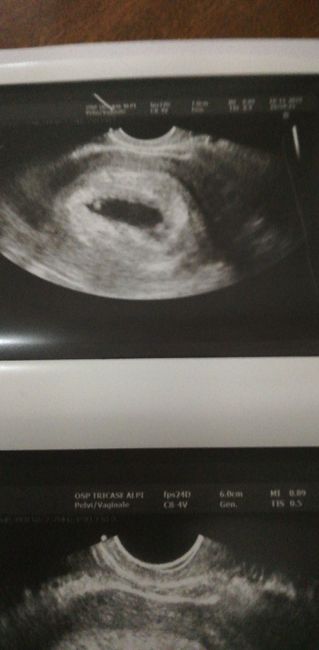 Ecografia 1
