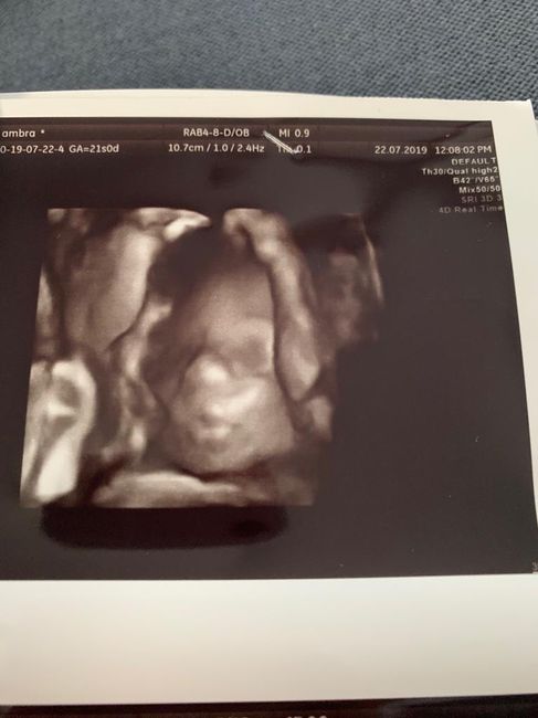 Future mamme "dicembrine" 2019 💙💗 - 1