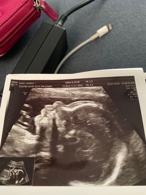 Future mamme "dicembrine" 2019 💙💗 - 2