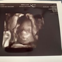 Future mamme "dicembrine" 2019 💙💗 - 1