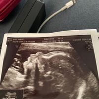 Future mamme "dicembrine" 2019 💙💗 - 2