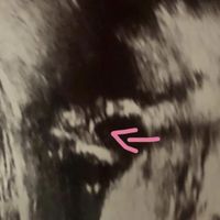 Femmina! e voi, cosa ne pensate? - 2