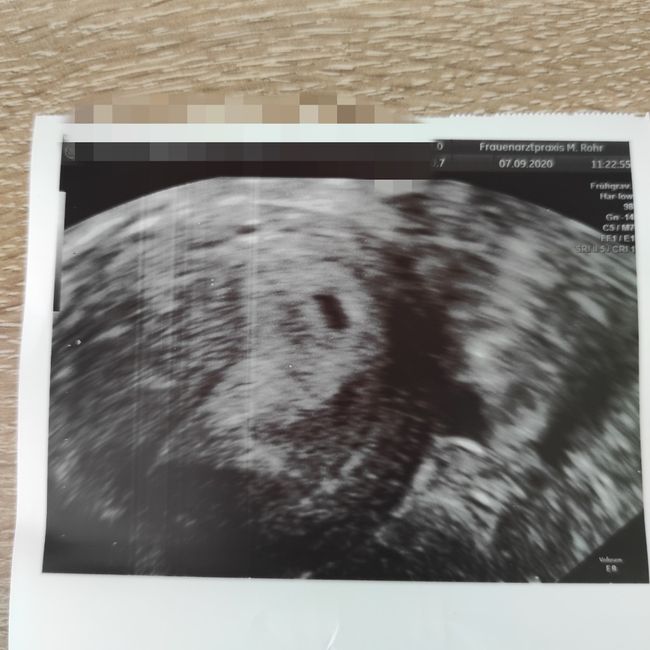 Dubbio camera gestazionale 2