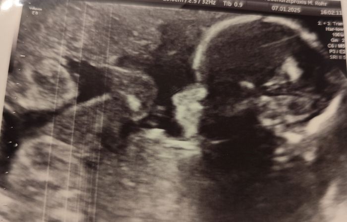 Future mamme Maggio 2025 💙💖 - 1