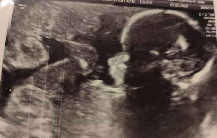 Future mamme Maggio 2025 💙💖 - 1