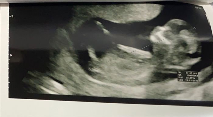 Mamme luglio 2020 - 1