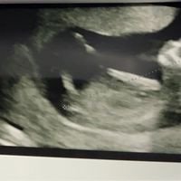 Mamme luglio 2020 - 1