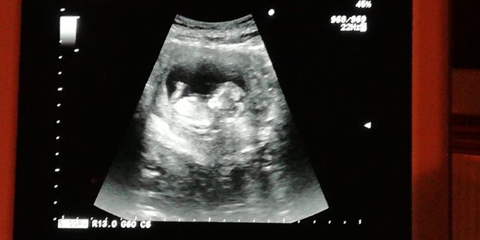 Future mamme Luglio 2021... - 1