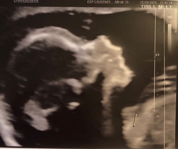 Future mamme Luglio 2021... 1