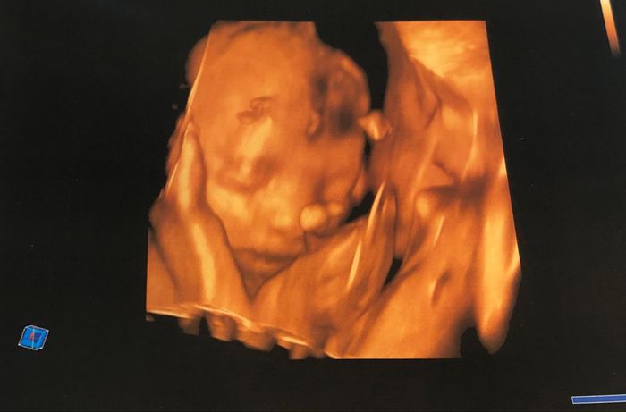 Future mamme Luglio 2021... - 1