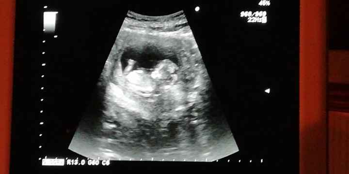 Future mamme Luglio 2021... - 1