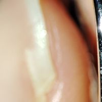 Anello Trilogy rovinato - 3