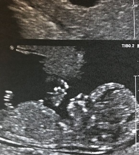 Mamme luglio 2020 - 1