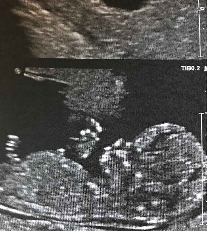 Mamme luglio 2020 - 1