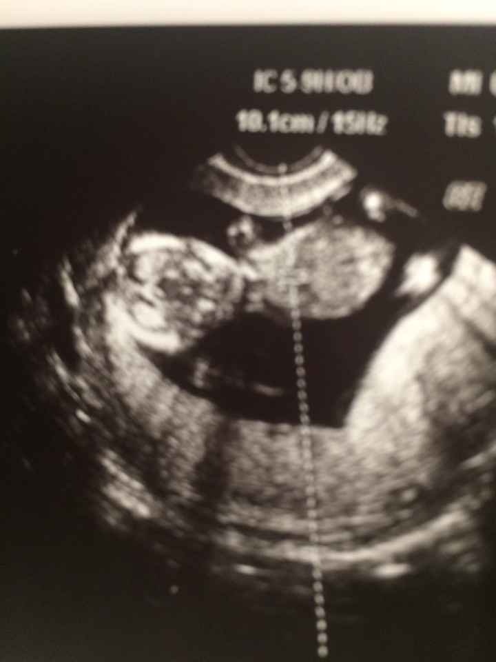 💙💙💙💙fiocco azzurro💙💙💙💙 - 2