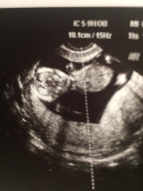 💙💙💙💙fiocco azzurro💙💙💙💙 - 2