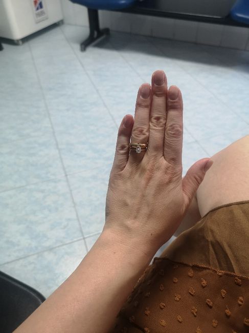 Anello di fidanzamento 1