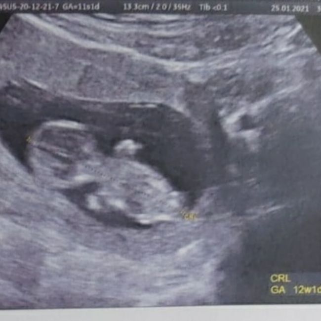 Future mamme Agosto 2021! 1