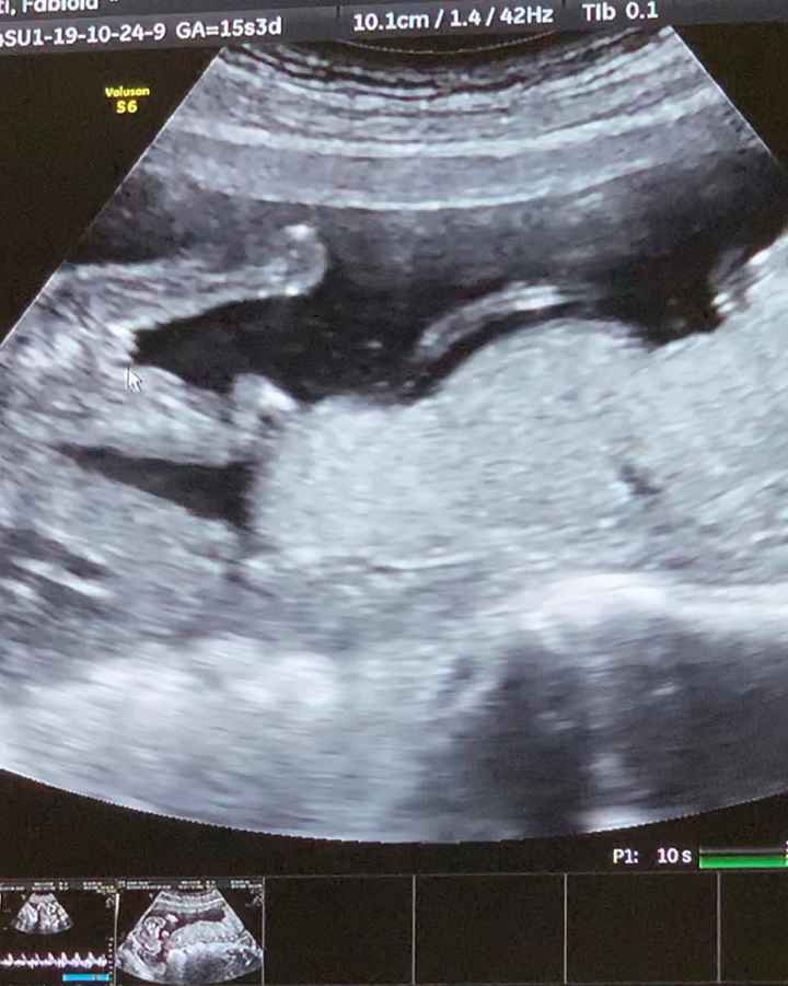 Mamme di Agosto 2020😍🤞😍 - 1