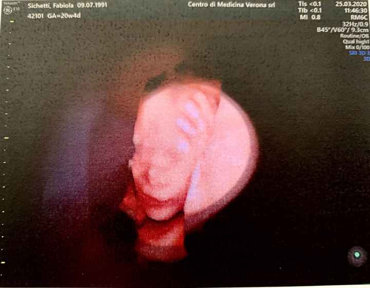 Esperienze? Morfologica e testina piccola - 1