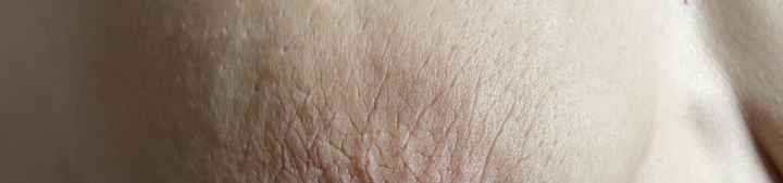 Seno post allattamento - 1