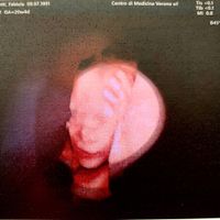 Esperienze? Morfologica e testina piccola - 1