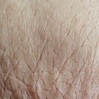 Seno post allattamento - 1