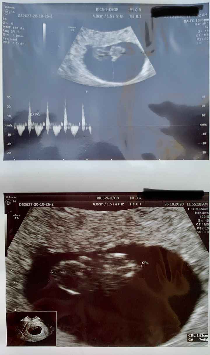 Future mamme Giugno 2021 💛🐠🍀🌻 - 1