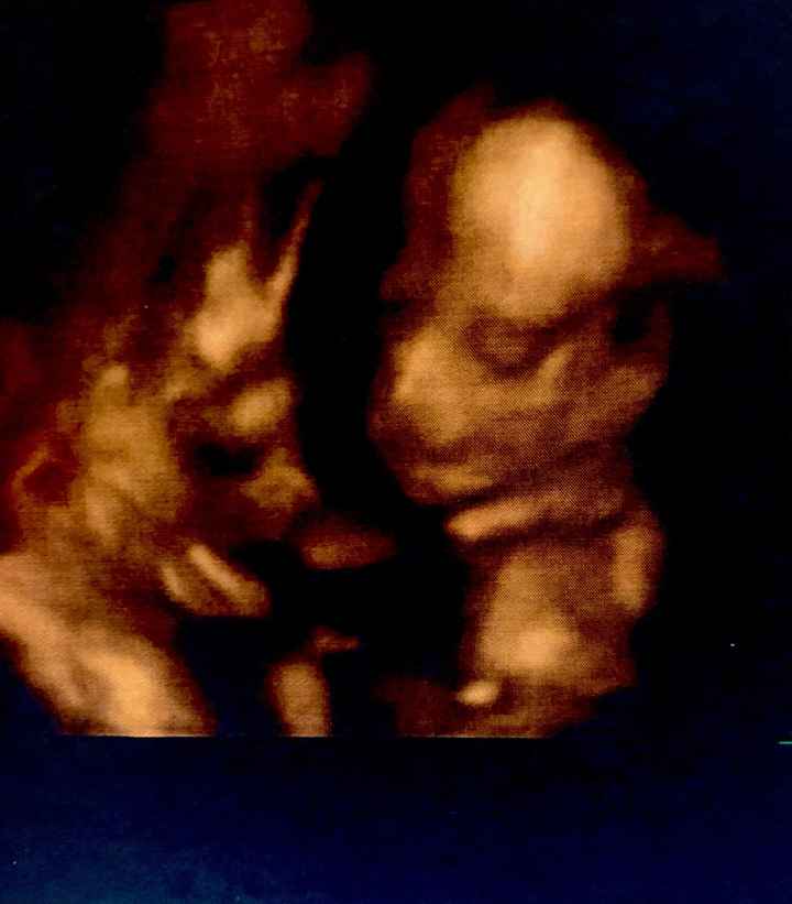 Future mamme Giugno 2021 💛🐠🍀🌻 - 1