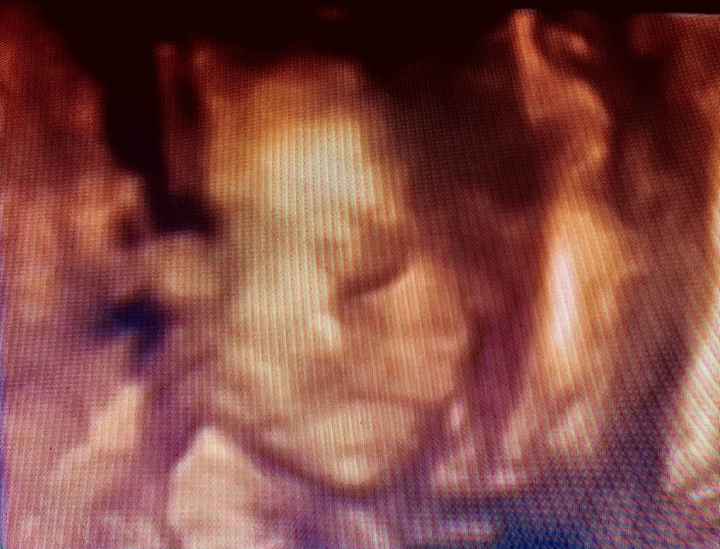 Future mamme Giugno 2021 💛🐠🍀🌻 - 1