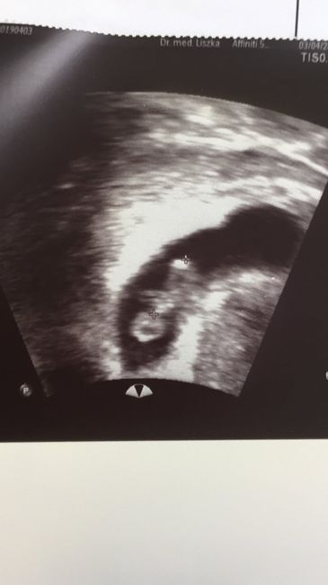 Brufoletti in gravidanza 🤰.. e quando direte ai vostri parenti di aspettare un bimbo? - 1