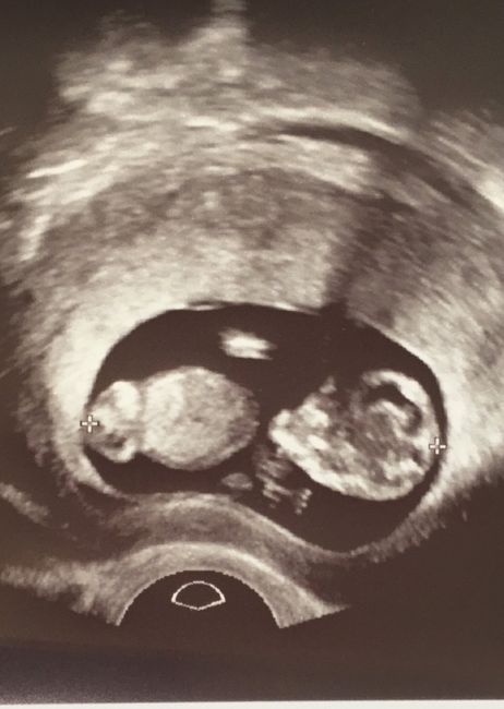 Future mamme di novembre - 1