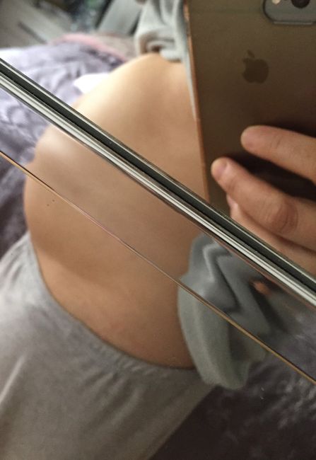 Pancia troppo piccola? 7