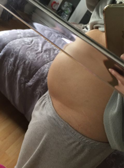 Pancia troppo piccola? 9