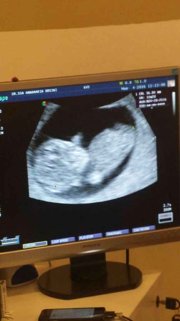 Il mio piccolino/a - 1