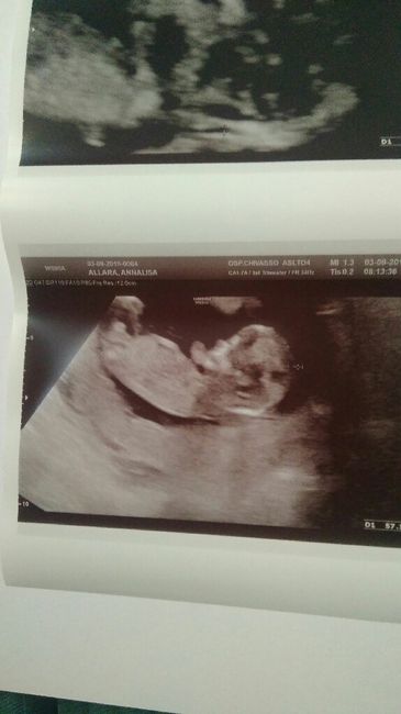 Esperte Nub Theory - 1