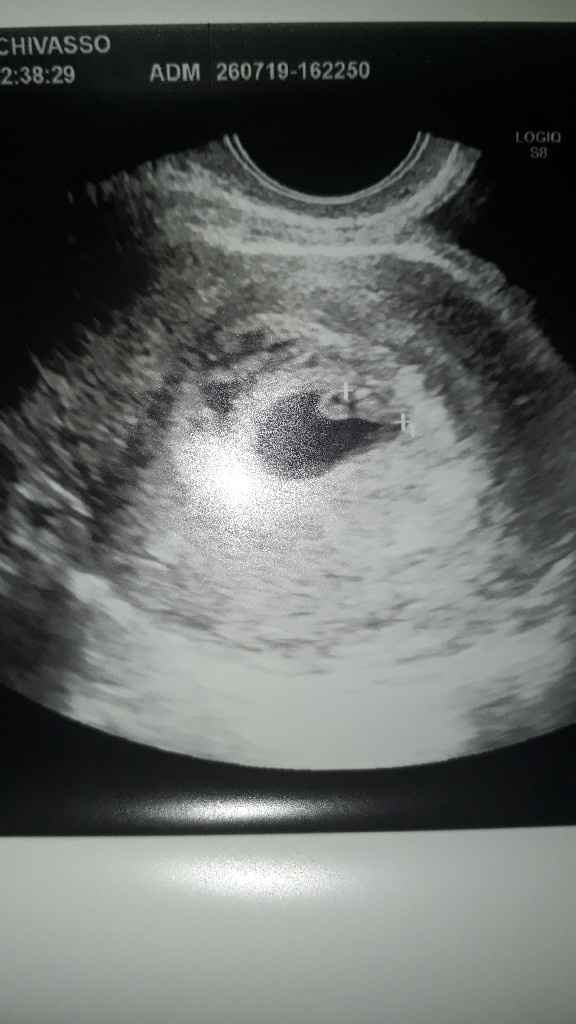 Maschio o femmina??? 👦🏻 o 👧🏻 - 1