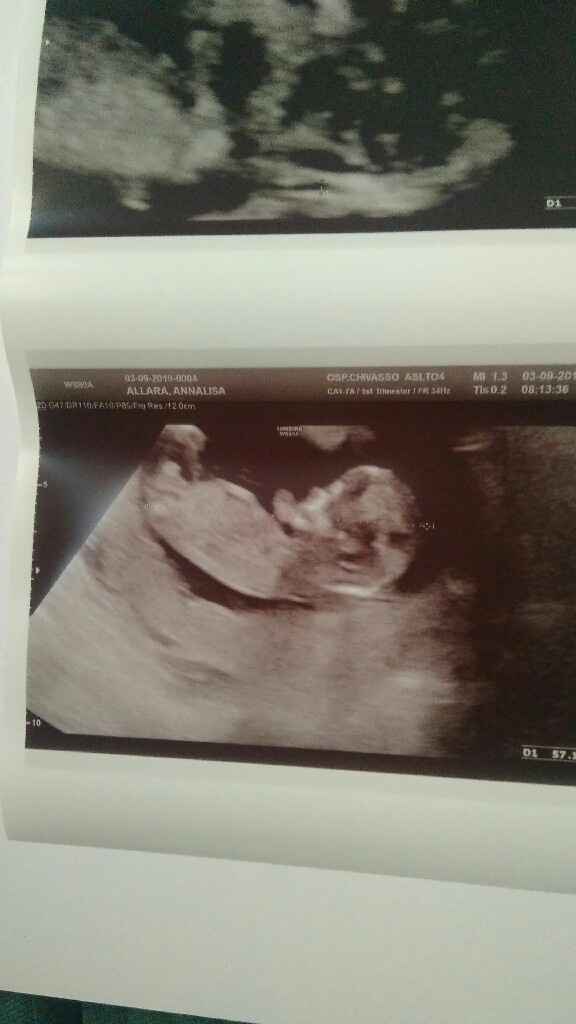 Emozione unica!!!!! - 1