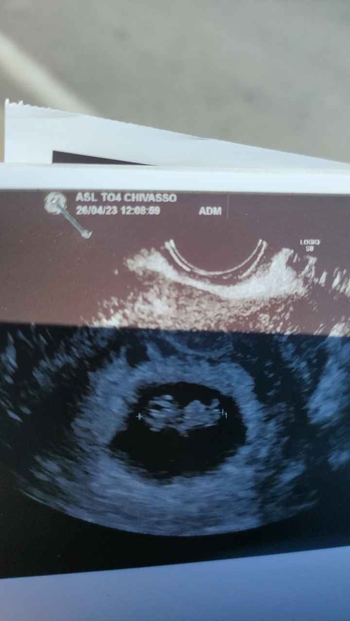 Nub theory. Maschio o femmina?💙🎀 - 2