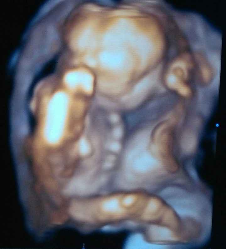  Ecografia 3d è un amore!!!! Gioia infinita! - 1