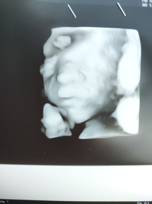 💙💜future mamme di Maggio 2022💙💜 3