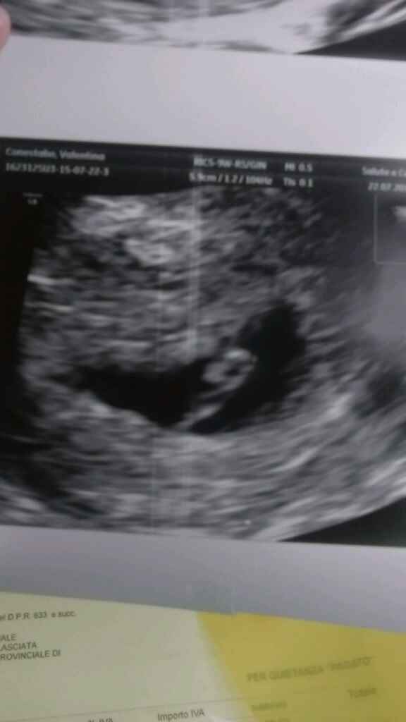 Eccolo...finalmente la prima eco - 1