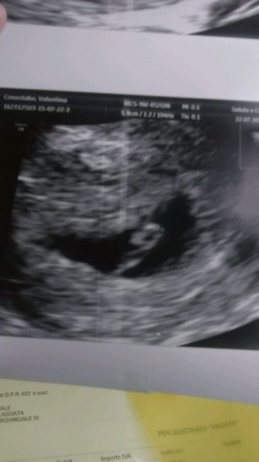 Eccolo...finalmente la prima eco - 1