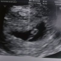 Eccolo...finalmente la prima eco - 1