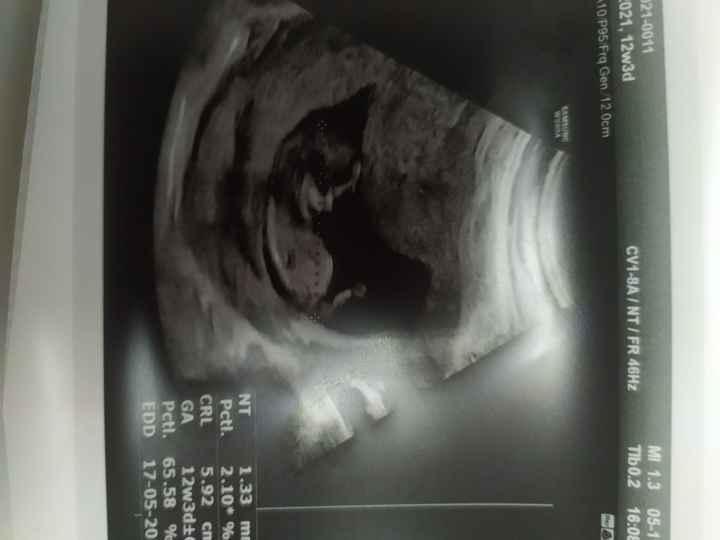 💙💜future mamme di Maggio 2022💙💜 - 1