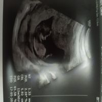 💙💜future mamme di Maggio 2022💙💜 - 1