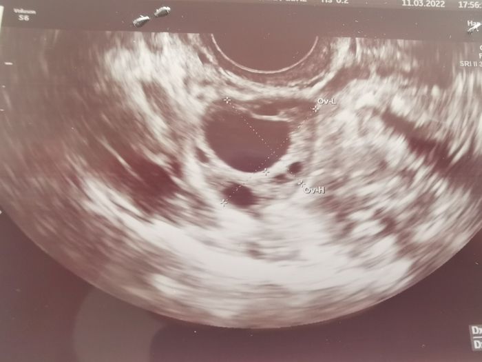 Chi non le aspetta per Aprile 2022 💓🍀🤞🏼 - 1